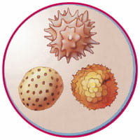 FuerMich_Asthma_Ausloeser-Pollen